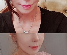 코성형 후기~한달차입니다^^