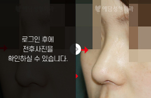 화살코