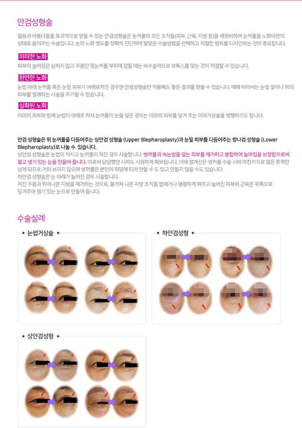 이미지명