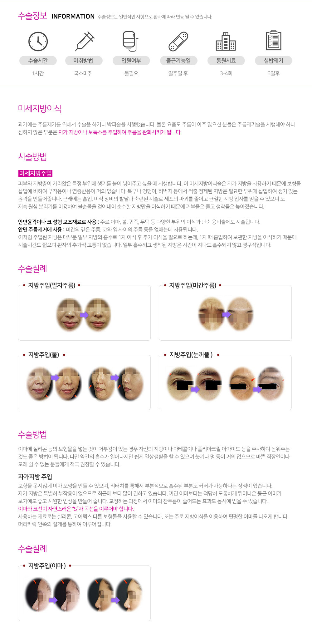 이미지명